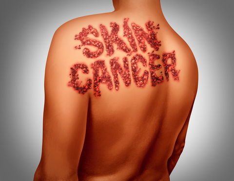 Cancer recurrence is a real fear for survivors
