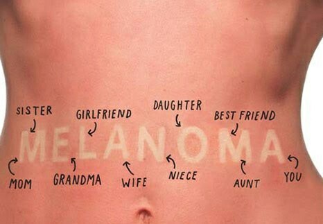 Defeating Melanoma via research